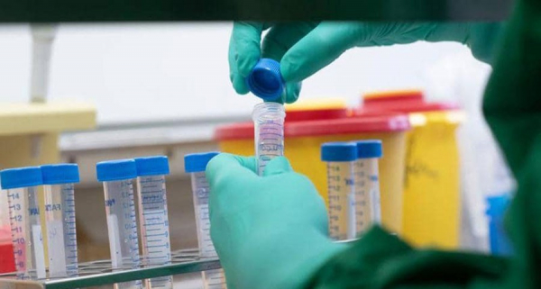 اختبار اللقاح الروسي ضدّ فيروس كورونا على كبار السن