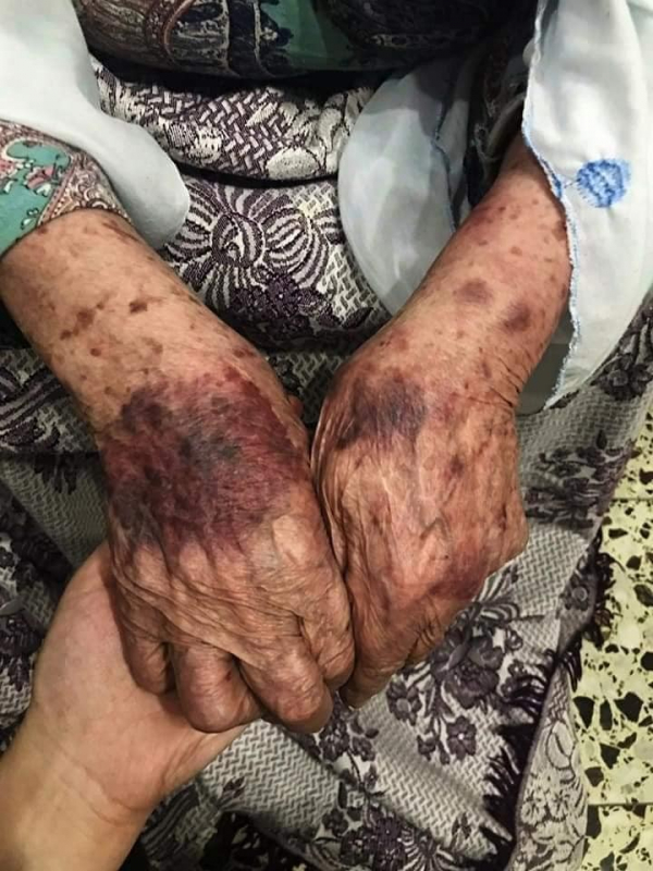 &laquo;الديمقراطية&raquo; ترفض استخدام القوة المفرطة ضد عائلة وشاح  وتدعو لتشكيل لجنة تحقيق