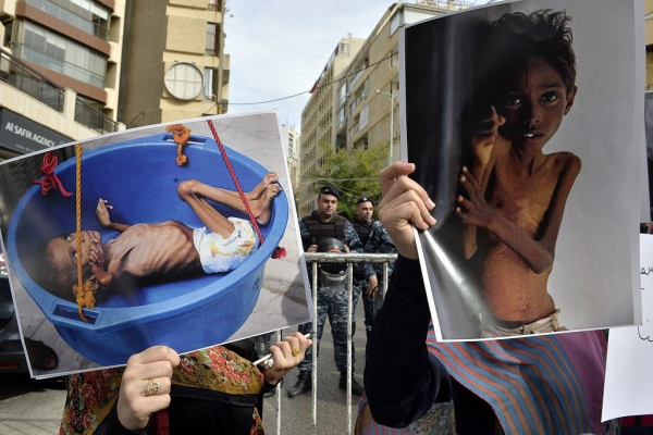 تحذيرات أممية من خطر المجاعة في اليمن و16 بلداً آخر من ضمنها لبنان